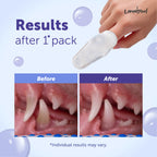 Loveabowl Clean-A-Tooth Dogs Dental Cleaning Wipes